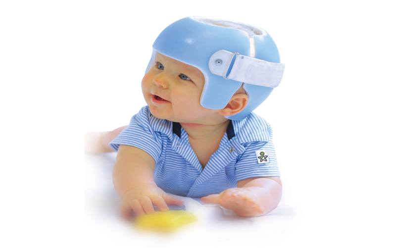Escanear la cabeza de un bebé para hacer un casco tipo órtesis